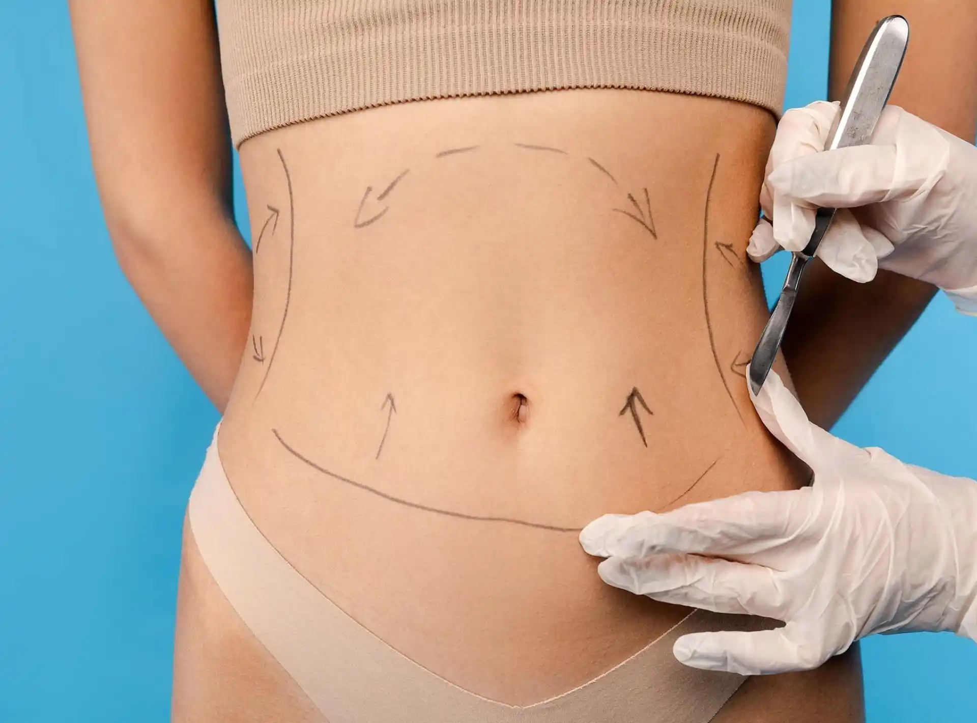 liposuction لیپوساکشن