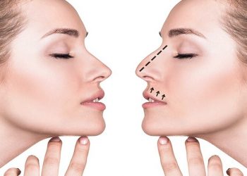 بهترین جراح بینی ترمیمی در جردن