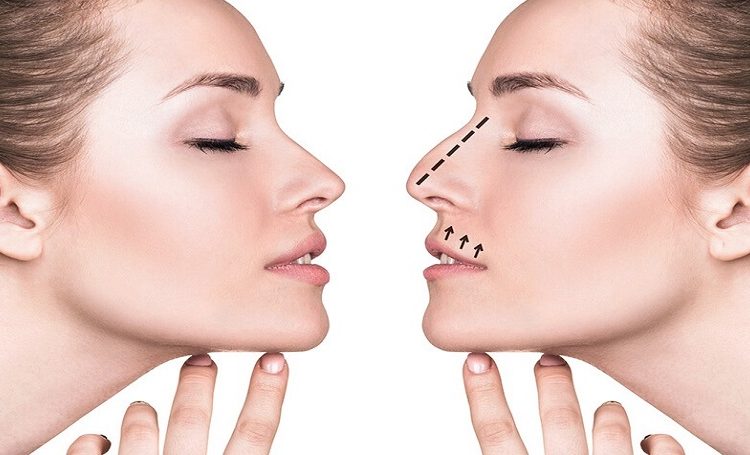بهترین جراح بینی ترمیمی در جردن