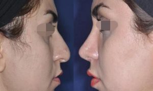 بهترین دکتر لیپوماتیک در جردن