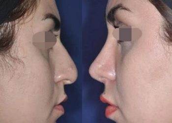 بهترین دکتر لیپوماتیک در جردن