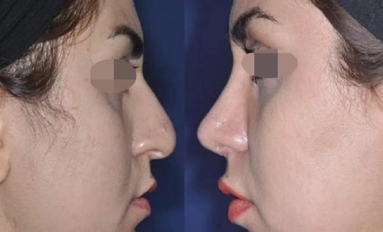 بهترین دکتر لیپوماتیک در جردن