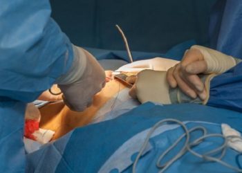 بهترین جراح پستان در ولنجک