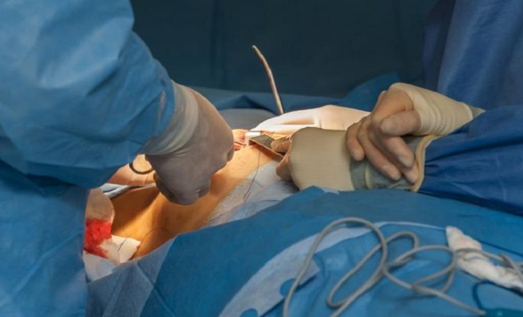 بهترین جراح پستان در ولنجک