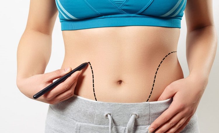 بهترین دکتر لیپوماتیک در جردن