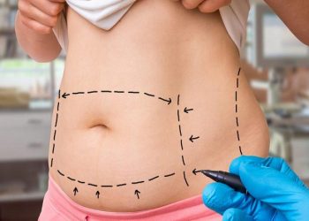 بهترین دکتر پیکر تراشی در جردن