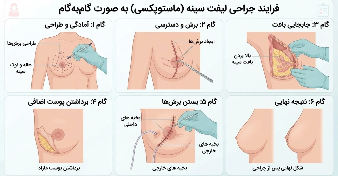 ماموپکسی