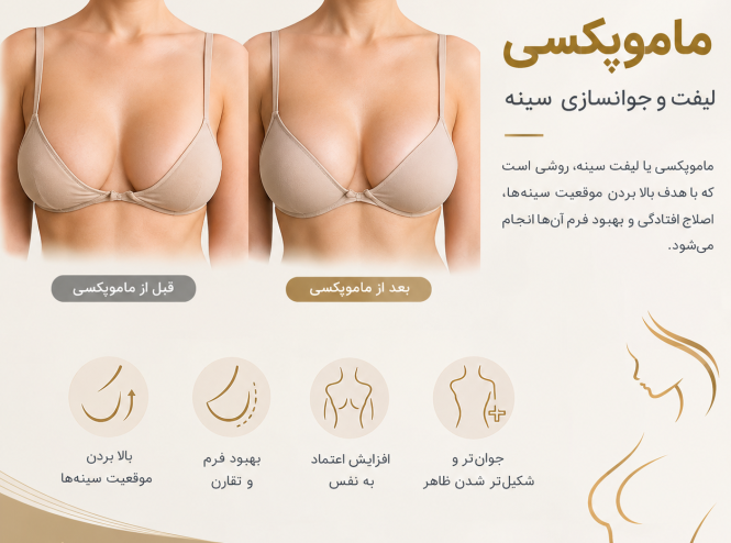 ماموپکسی