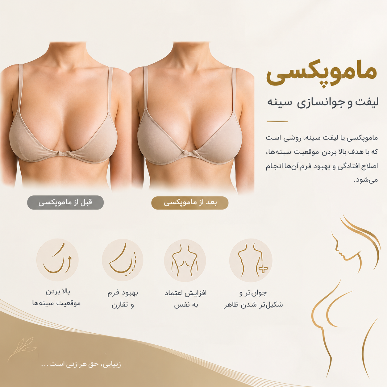 ماموپکسی