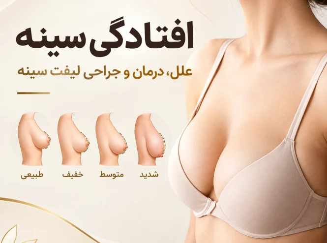 افتادگی سینه